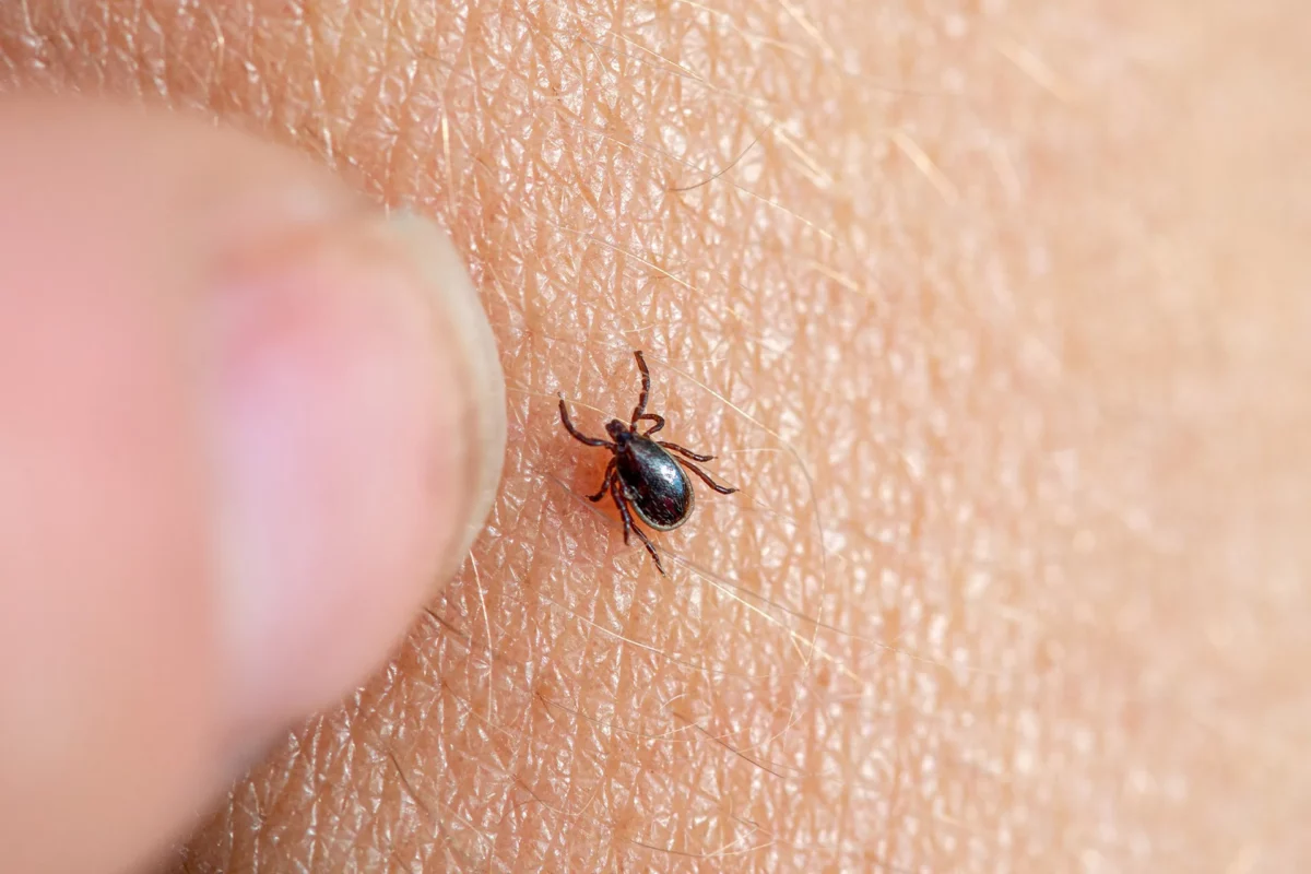 Zecke auf menschlicher Haut wird mit Finger gezeigt als Hinweis auf FSME Risiko